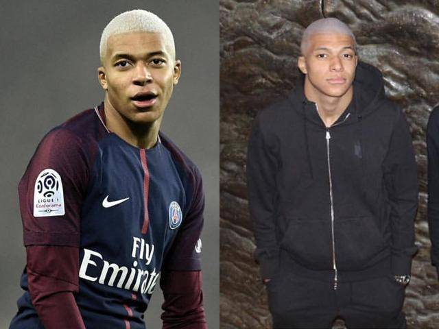 眼眶塌陷！赵鸿刚拳击生涯或终结，转型还是再战成艰难抉择